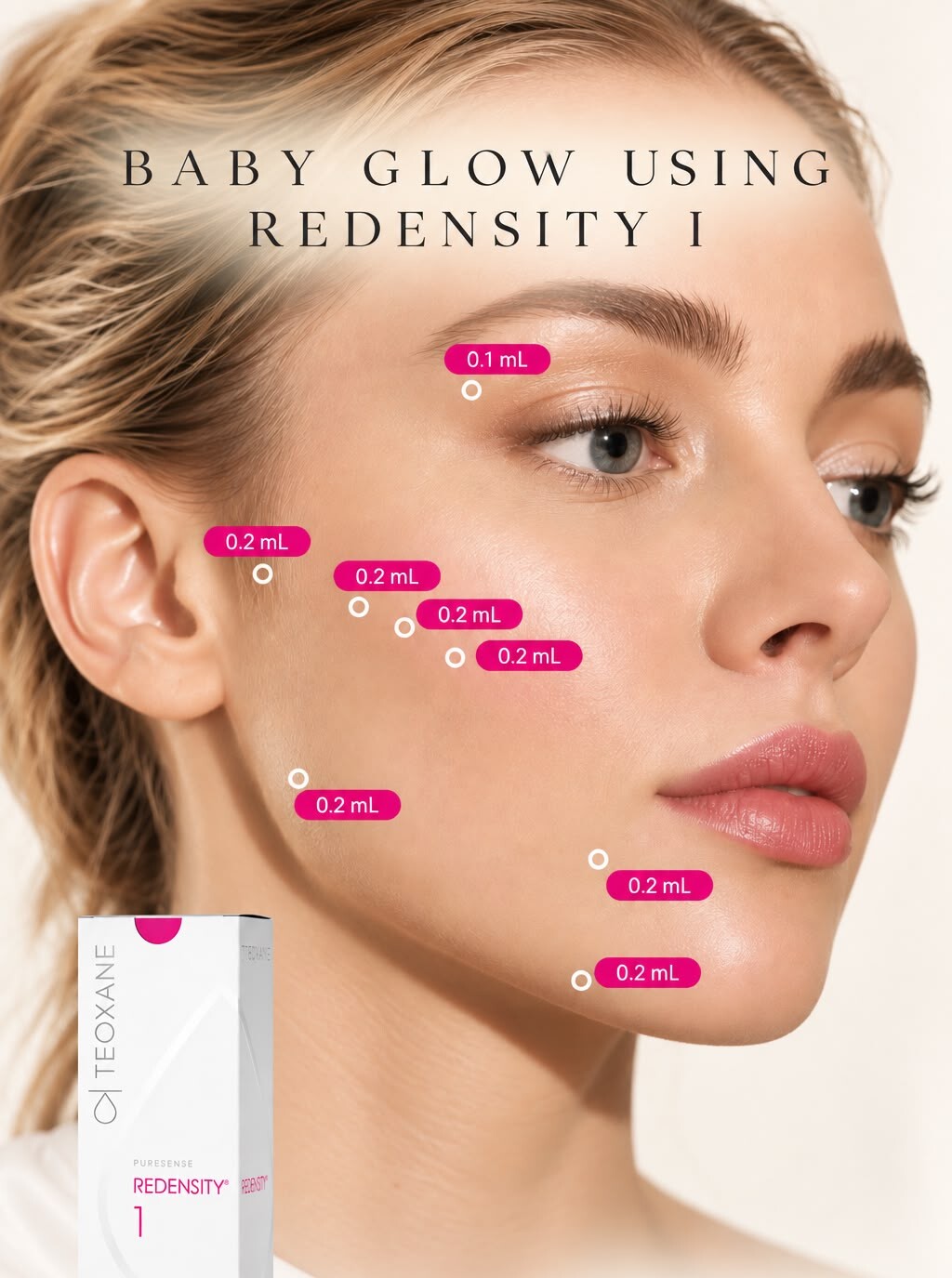 Skin booster placed at mapped injection points
